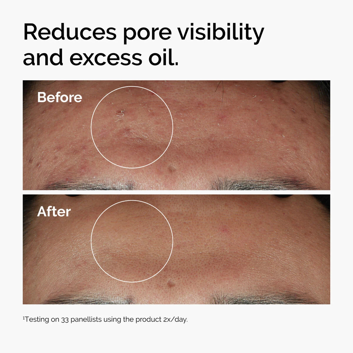 niacinamide the ordinary peru
